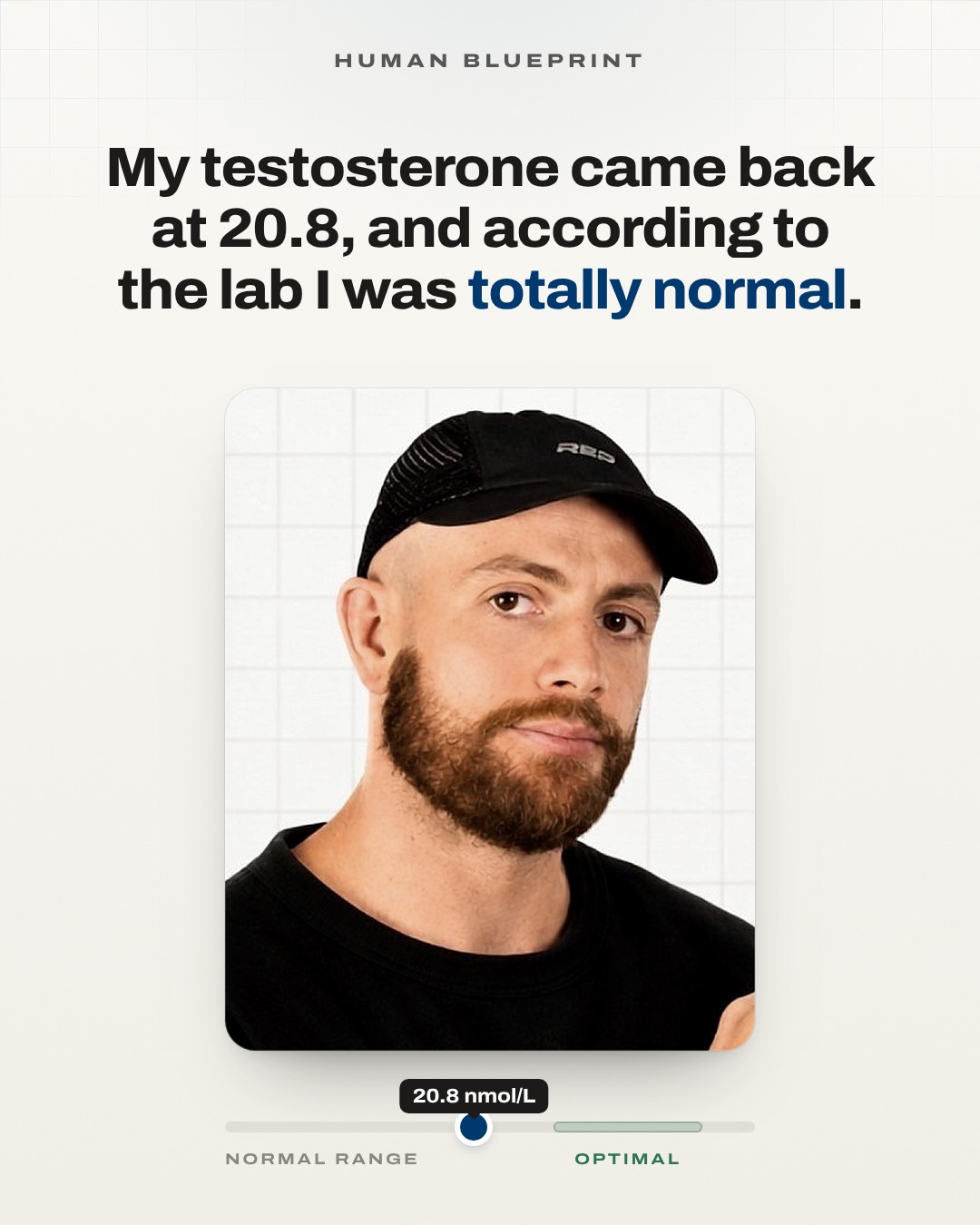 Slide 1: My testosterone came back at 20.8, and according to the lab I was totally normal.